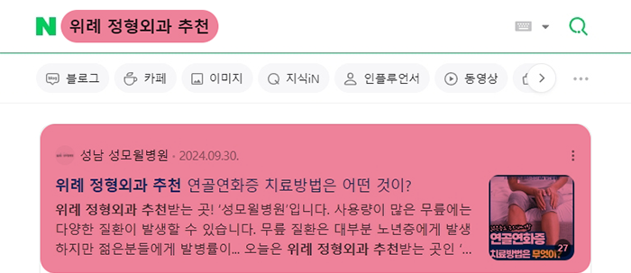 View탭 상위노출 아이패드 이미지